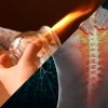Pack Workshop: Sistema Osteomuscular & Ventosaterapia